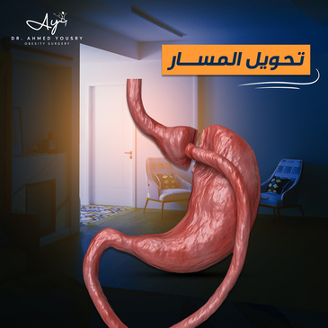 Slider image (6) Dr. Ahmed Yousry Clinic